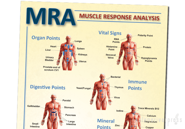 MRA chart